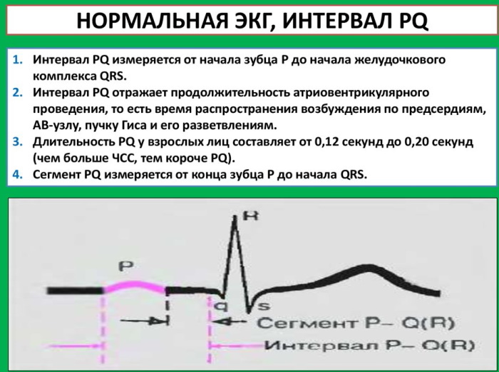 Kaip patiems perskaityti širdies elektrokardiogramą. EKG dekodavimas