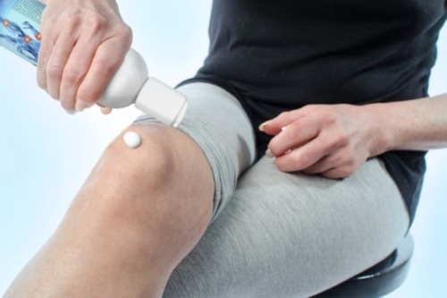 The best ointments for knee arthritis. Reviews