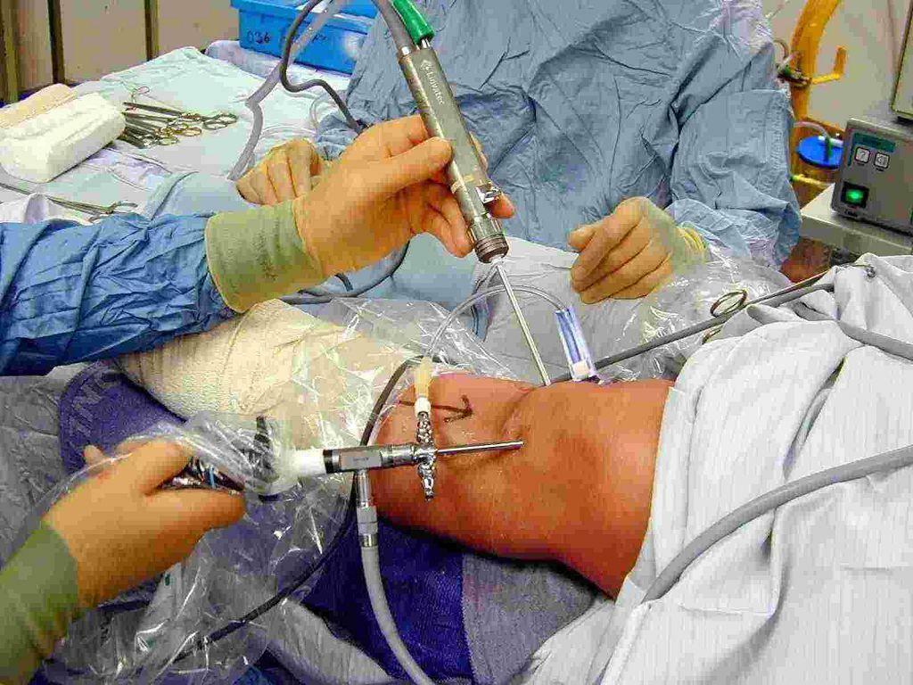 Examinarea endoscopică a cavității articulare a articulației genunchiului