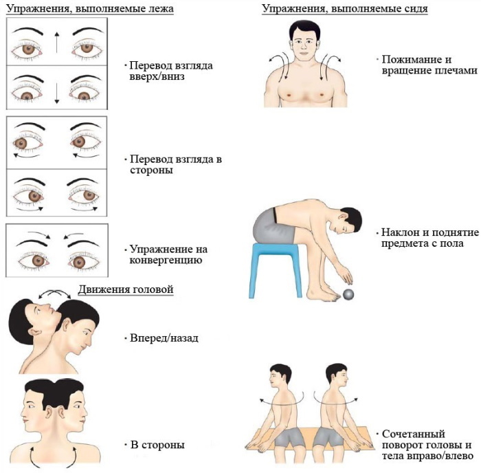 Vestibulaire neuronitis. Symptomen en behandeling, lichaamsbeweging