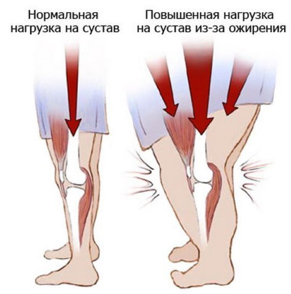 Brûlure dans les jambes sous le genou. Causes et traitement