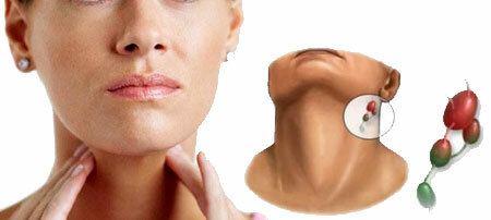 A nyaki nyirokcsomók gyulladásának tünetei