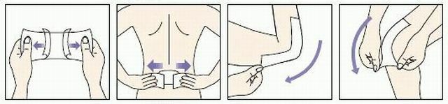 Hvordan man bruger et bedøvelsesgips
