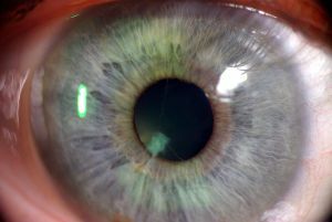 Pupil and retina
