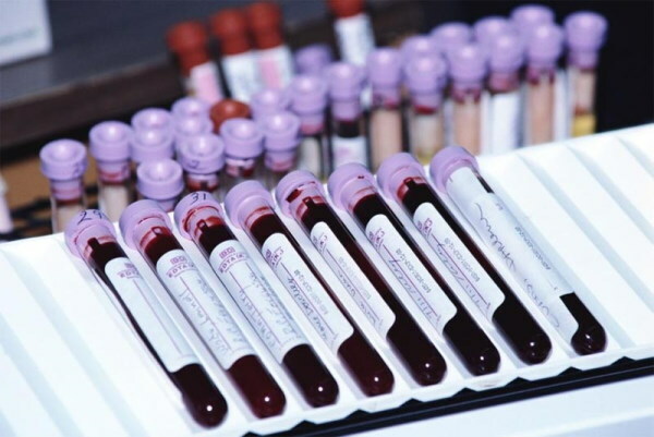 Typer blodprøver: hva er, navn
