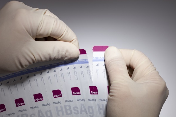 HBsAg blood test. What it means: negative, positive, transcript