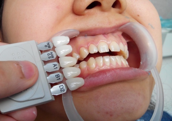 Zubar ortoped. Ono što odraslu osobu, dijete čini razliku s ortodontom