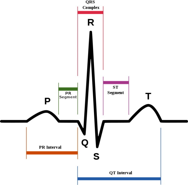 PQ-Verkürzung im EKG. Was bedeutet das