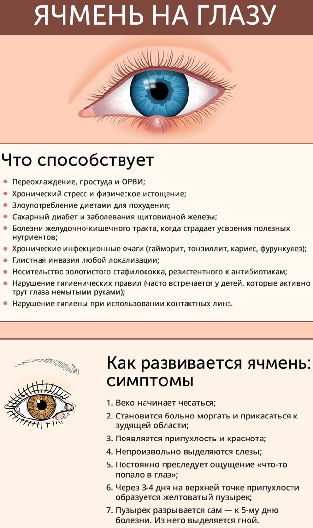 Svrbiace oči. Príčiny a liečba, kvapky