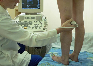 Kojų ultragarsas