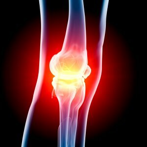 Joint with osteoarthritis