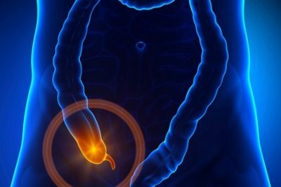 Acute gangrenous-perforated appendicitis: what is it?