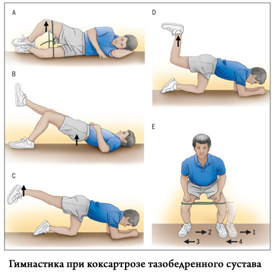 Ejercicios para las articulaciones de la cadera con coxartrosis, artrosis, dolor según Bubnovsky, Evdokimenko. Video