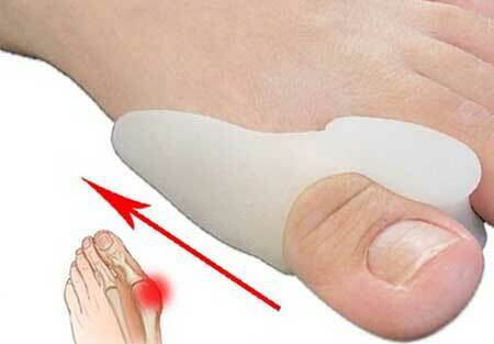 a hüvelykujj közelében lévő láb csontja fáj