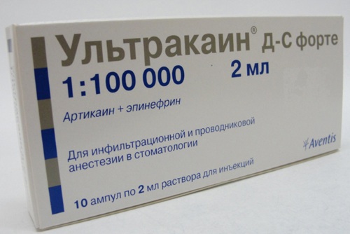 Ultracain (Ultracain). Price for 1 ampoule, instructions for use, composition