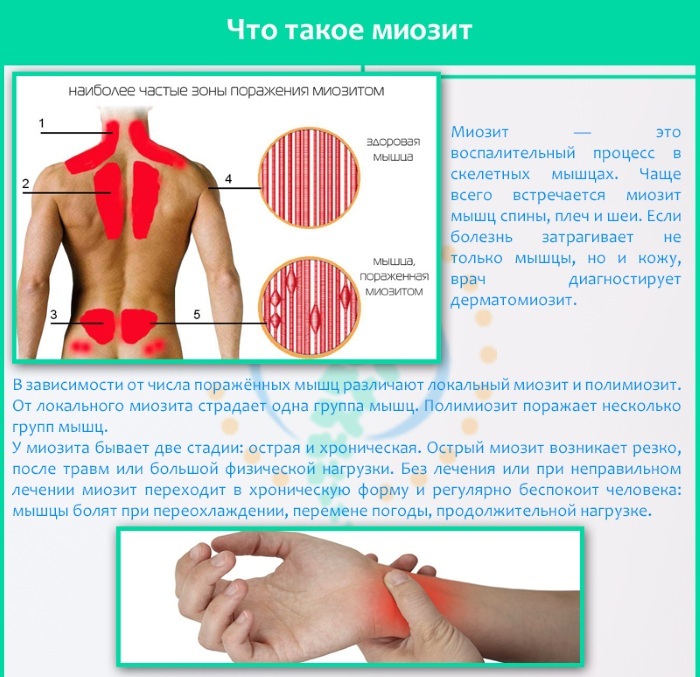 Temperature for osteochondrosis of the cervical, lumbar, thoracic spine