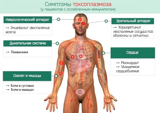 Toxoplasmosis. Symptoms in a child, treatment 2-3-4-5 years, clinical guidelines