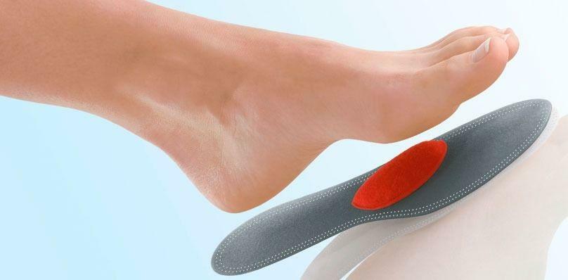 Planos ortopédicos. Tratamento de pés planos