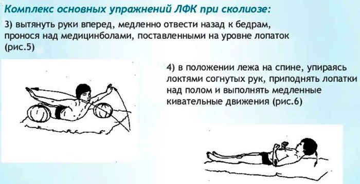 Exercise therapy gymnastics for the back and spine with scoliosis, hernia, osteochondrosis of children, adults