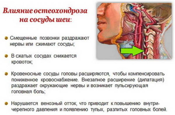 El hemisferio derecho de la cabeza, la parte posterior de la cabeza, la sien duele. Causas y tratamiento