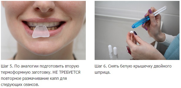 Clareamento dental caseiro com protetores bucais. Comentários, preço