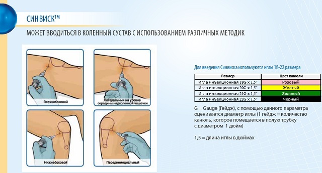 Recensioni e istruzioni per il liquido sinoviale della protesi Synvisc