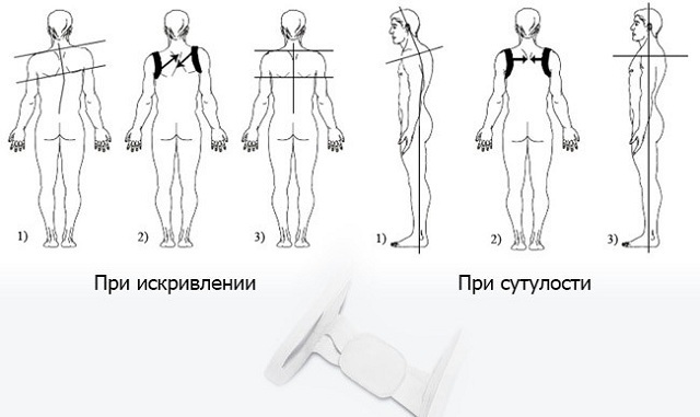 Corretor de postura do cinturão do tórax: as costas vão te agradecer.