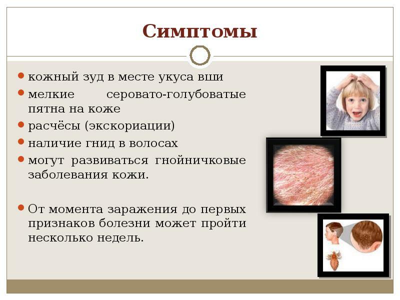 Symptoms of Lice