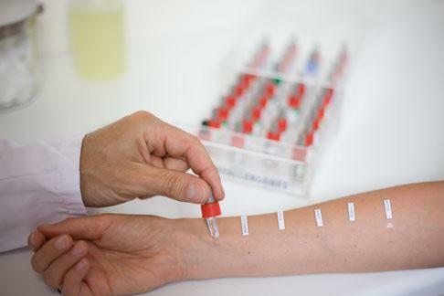 Conducting an allergy test