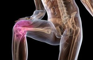 poruchy kolenného kĺbu