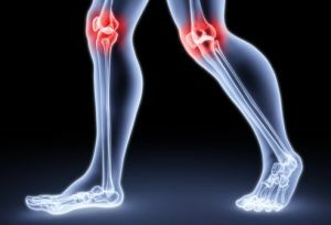 Pain of uncertain genesis or arthralgia of the knee joint