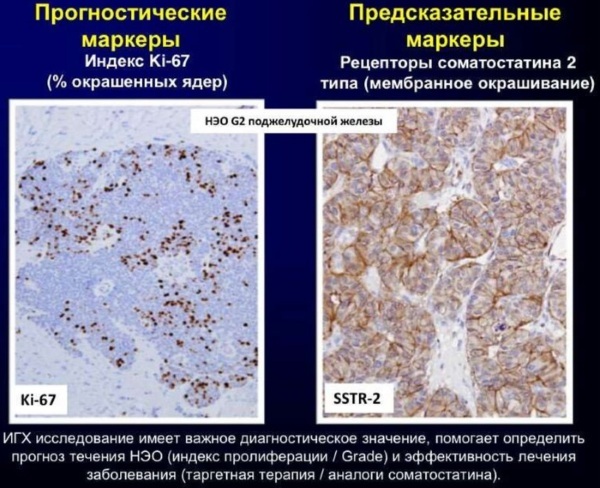 IHC research. What is it, how is it carried out, transcript