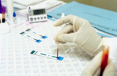 Bluttest für HCG