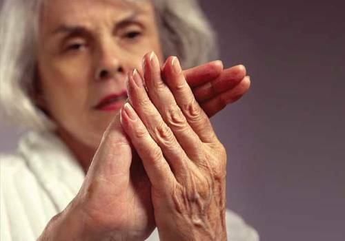 Osteoarthritis often occurs in people after 40 years of age