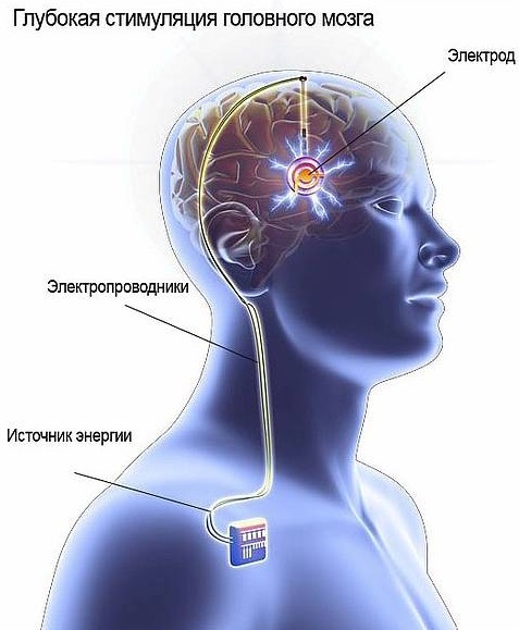 Tourette's syndrome. What is it, why does it appear, symptoms, treatment