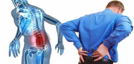 Lumbago: symptoms and treatment + lumbago with sciatica, what is it?