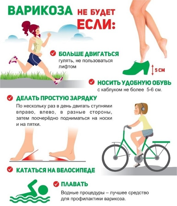 Varicose veins during pregnancy. Symptoms and treatment in women on the legs. Than to smear, exercises, stockings