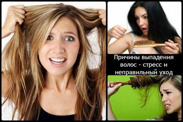 Causes de la perte de cheveux
