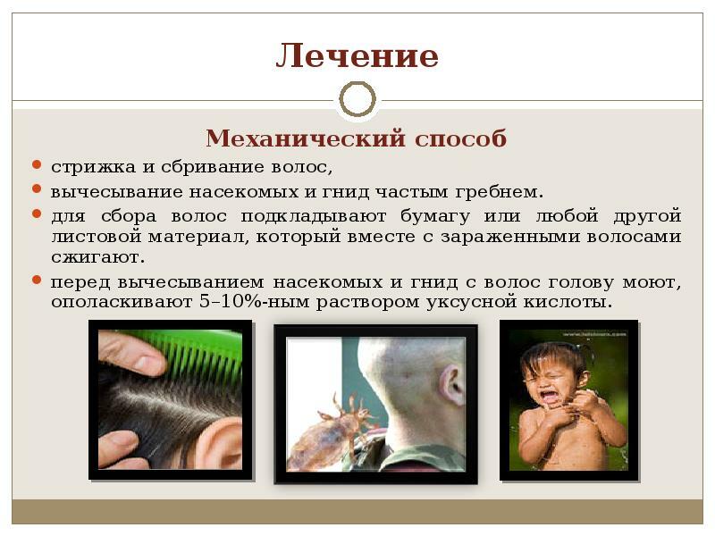 The mechanical method of treatment for pediculosis