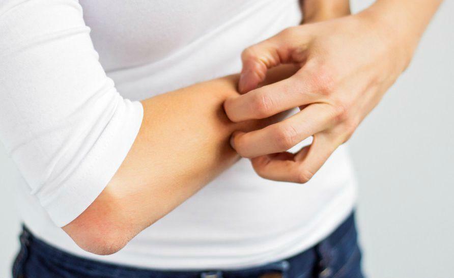 How to get rid of itchy skin of the body