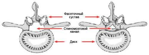 The vertebral canal is normal and struck
