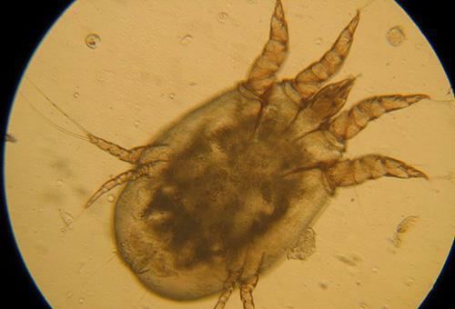 Scabies tick under the microscope