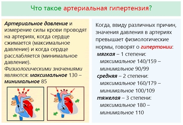 Harjutused puusaliigestele koksartroosi, artroosi, valu järgi Bubnovski, Evdokimenko järgi kodus. Video