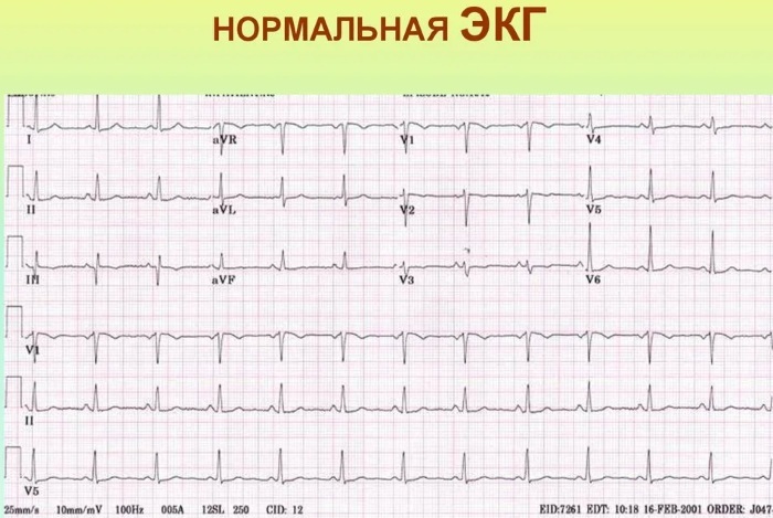 Pain in the region of the heart at rest. What is it, what to do