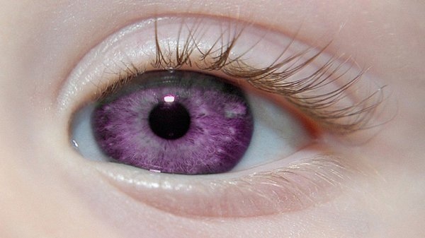עיניים סגולות בבני אדם מטבען. צילום, סיבות, קיים