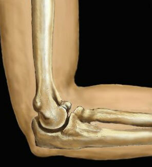Osteoarthritis of the elbow joint