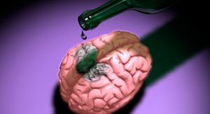 brain poisoning with alcohol