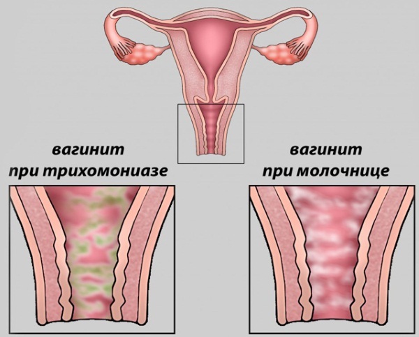 White flakes in the urine of women, men, children. The reasons what this means