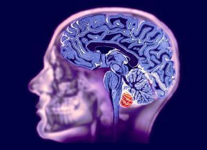 MRI do cérebro