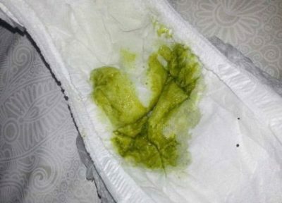 Green diarrhea in a child with and without temperature: the reasons for what to do?